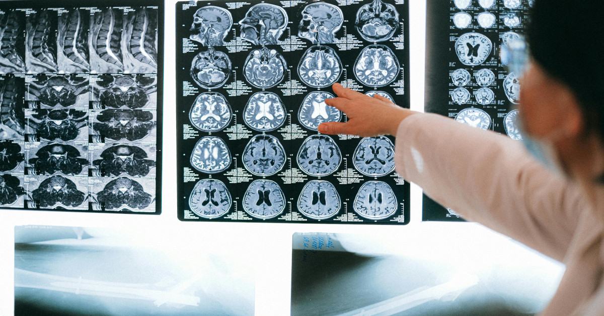 A healthcare professional explaining the MRI results of a brain to the patient.