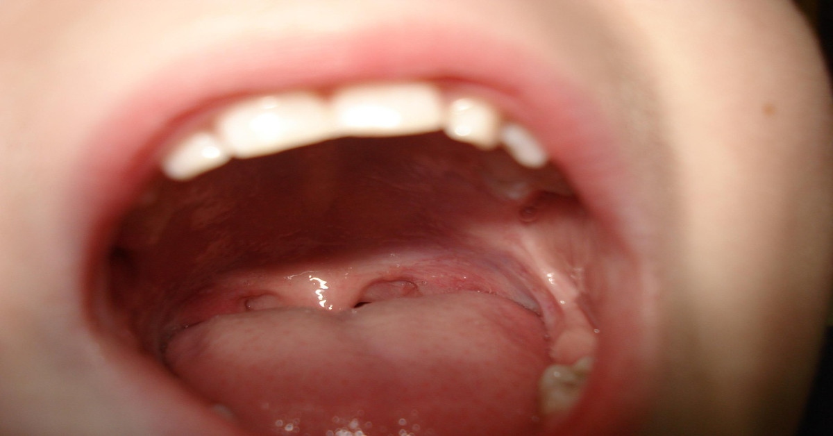 A person with an open mouth.